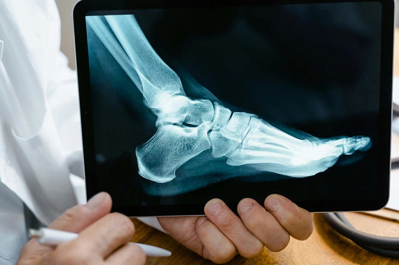 degital-xray-1-img